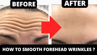 FACE YOGA FOR FOREHEAD WRINKLES  FACIAL EXERCISES FOR WRINKLES ON FOREHEAD [upl. by Mortie]