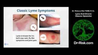 Lyme Disease Falling Through The Cracks  Dr Rebecca Risk [upl. by Nygem]