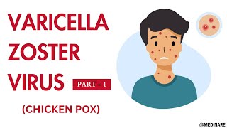 Varicella Zoster virus  Part 1  Made very easy  Medinare [upl. by Callum214]