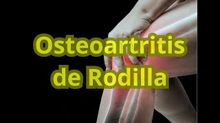 Osteoartritis de Rodilla y Acupuntura [upl. by Suzanne]