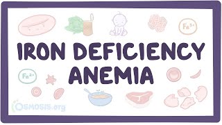 Iron deficiency anemia  an Osmosis Preview [upl. by Naihtniroc890]