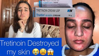 Quitting Tretinoin  Tretinoin destroyed my skin😭😫 [upl. by Iak884]