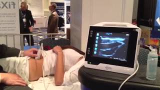 Ultrasound Guided Illeoingunal Nerve Block [upl. by Aicenat295]