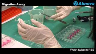 Migration Assay [upl. by Omsoc]