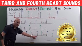 Mastering S3 and S4  Learn Third and Fourth Heart Sounds🫀 [upl. by Chrotoem705]