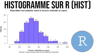 FAIRE UN HISTOGRAMME SUR R FACILEMENT  RStudio [upl. by Blaine]