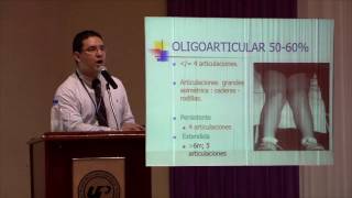 Artritis Reumatoidea en Niños y Adolescentes [upl. by Bonnice]