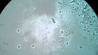 Trichomonas in urine wet mount 400x [upl. by Eed]