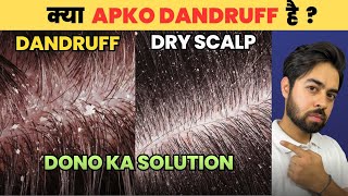 Say Goodbye to Dandruff or Dry Scalp HONEST SOLUTIONS [upl. by Aliemaj]