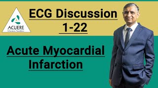 ECG Discussion 122  Acute Myocardial Infarction  2022 [upl. by Carolynn]