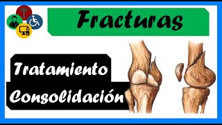 🦴 FRACTURAS  Tipos CONSOLIDACIÓN y TRATAMIENTO fractures [upl. by Husein]