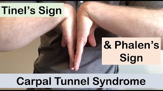 Carpal tunnel syndrome  Tinel’s sign and Phalen’s sign  Clinical Examination [upl. by Ratna854]