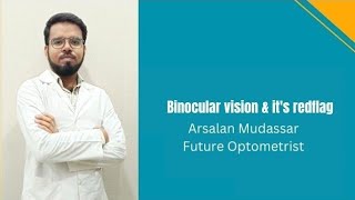 Binocular vision amp its redflag explained by Arsalan Mudassar [upl. by Kcirdahs745]