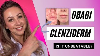 Obagi CLENZIderm MD System  UNBEATABLE ACNE RESULTS [upl. by Ahsinnod118]