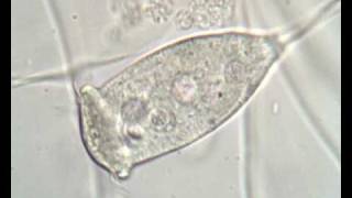 Vorticella sp in activated sludge [upl. by Sassan]