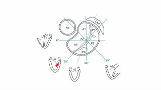 How to image the mitral valve with the help of TEE [upl. by Kaiulani]