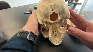 Skull Frontal Parietal and Occipital Bone and their bone markings [upl. by Tnerual]