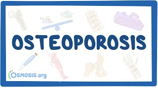 Osteoporosis  causes symptoms diagnosis treatment pathology [upl. by Anelhtac]