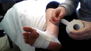 Taping techniques for plantar fasciitis [upl. by Neda]