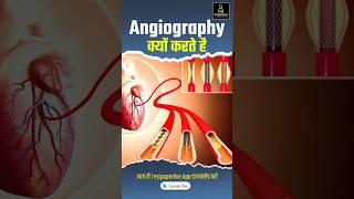 What is Angiography in Hindi angiography radiographerexam testpaperliveparamedicalclasses [upl. by Aitram]