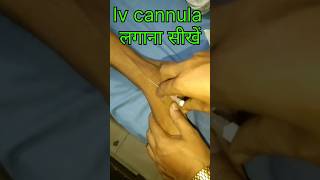 Iv cannulation technique motivation viralvideo nursing doctor shorts [upl. by Alberto244]