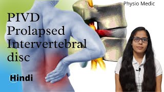 Introduction  Prolapsed Intervertebral DiscPIVD  Made Easy  Hindi  Part 1 Back Pain [upl. by Anivek593]