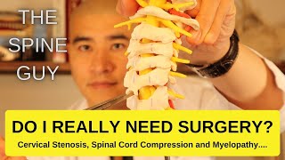 Cervical Stenosis Spinal Cord Compression and Myelopathy DO I REALLY NEED SURGERY [upl. by Enihpad942]