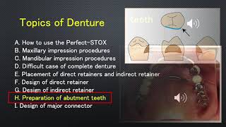 Preparation of abutment teeth [upl. by Oratnek]