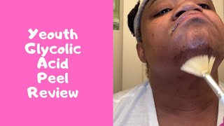 Yall its Product Review Time Yeouth Glycolic Acid Gel Peel [upl. by Vilhelmina]