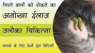 Leech Therapy for Hair Fall Acne Pimples and Blemishes  Leech Therapy for Skin Diseases [upl. by Anahoj105]