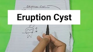 Eruption Cyst Oral PATHOLOGY [upl. by Renado412]