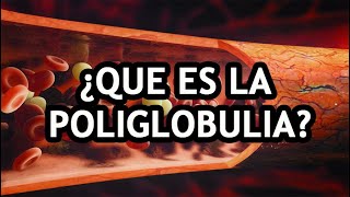 🔴 ¿QUE ES LA POLIGLOBULIA [upl. by Hildegarde]