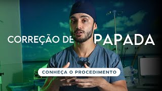 CORREÇÃO DE PAPADA CONHEÇA O PROCEDIMENTO [upl. by Thera]