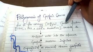 pathogenesis of gastric cancer NGMedicals [upl. by Bald]