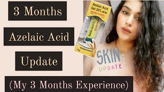 3 Months Azelaic Acid Update  My Experience with Azelaic Acid aziderm AzelaicAcid acnetreatment [upl. by Einiar187]