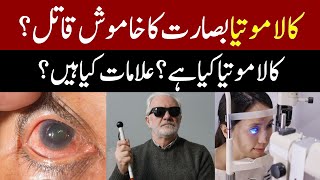 کالا موتیا بصارت کا خاموش قاتل؟  Glaucoma  Eye Cataract  Kala Motia  Health Tips [upl. by Lesly]