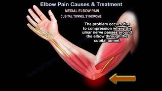 Elbow Pain Causes amp Treatment what causes elbow pain and how is it treated Tennis elbow [upl. by Ashlee]