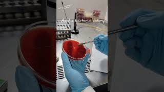 Catalase Test Procedure catalase lab pathology [upl. by Alberta]