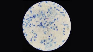 Sputum Test AFB StainingMLT PRACTICAL [upl. by Einohpets65]