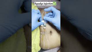 Fat loss treatment Aqualyx injectionsafe amp Effective treatment skin smile clinic Bhopal fatloss [upl. by Nicholas]