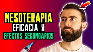 Mesoterapia Con Dutasteride Para Recuperar El Pelo [upl. by Novyart]