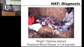 Trypanosomiasis Leishmaniasis Chagas Part 1  2013 Global Health Disasters Course [upl. by Nareht698]