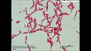 Bacillus cereus Spore stain SchaefferFulton Method [upl. by Ydroj717]