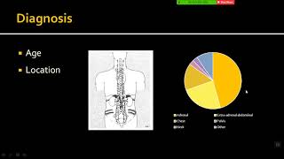 Imaging of Neuroblastoma [upl. by Shaffert]