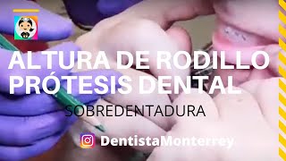 Cómo se Ajusta❓ RODILLO👅 SOBRE DENTADURA [upl. by Jegar]