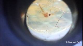 Anopheles mosquito under dissecting microscope [upl. by Harahs]