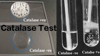 Catalase Test [upl. by Esiuole453]