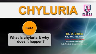 CHYLURIA  What is chyluria amp why does it happen [upl. by Aleda465]