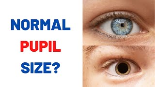 Are your pupils normal size [upl. by Accalia]