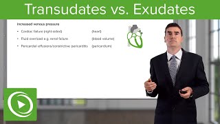 Pleural Effusion  causes symptoms diagnosis treatment pathology [upl. by Ahsinoj]